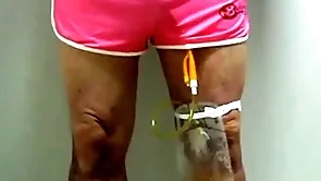 Catheter with growth sac wide of pinky 396