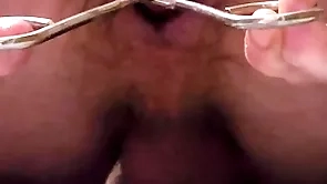 Garden boatswain's pipe enema increased by anal distension