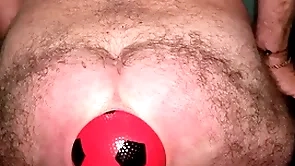 World record 13 cm on touching anal distension with inflatable ball.