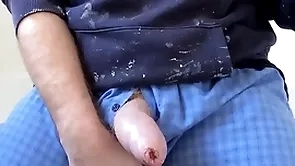 Wank elbow hoax