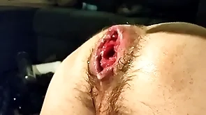 Just fisting my depraved hole and prolapse:)